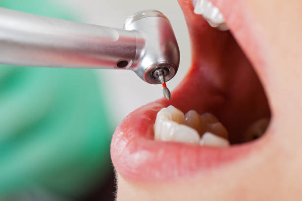 Best Emergency Dental Surgery in Beattystown, NJ